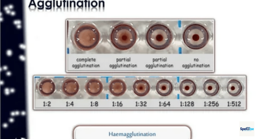 Turkish Agglutination Explained